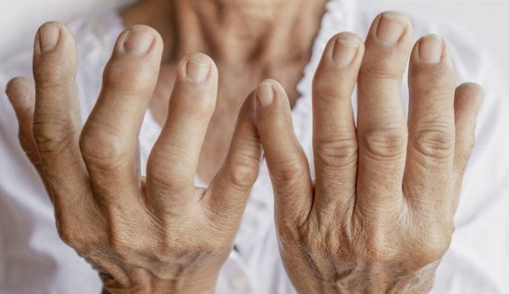 Suplementos naturales para prevenir la artrosis