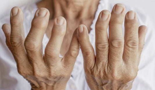 Suplementos naturales para prevenir la artrosis